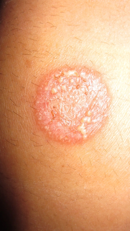 Blickdiagnose-Quiz Fall 11: klinisches Bild – welche Diagnose?