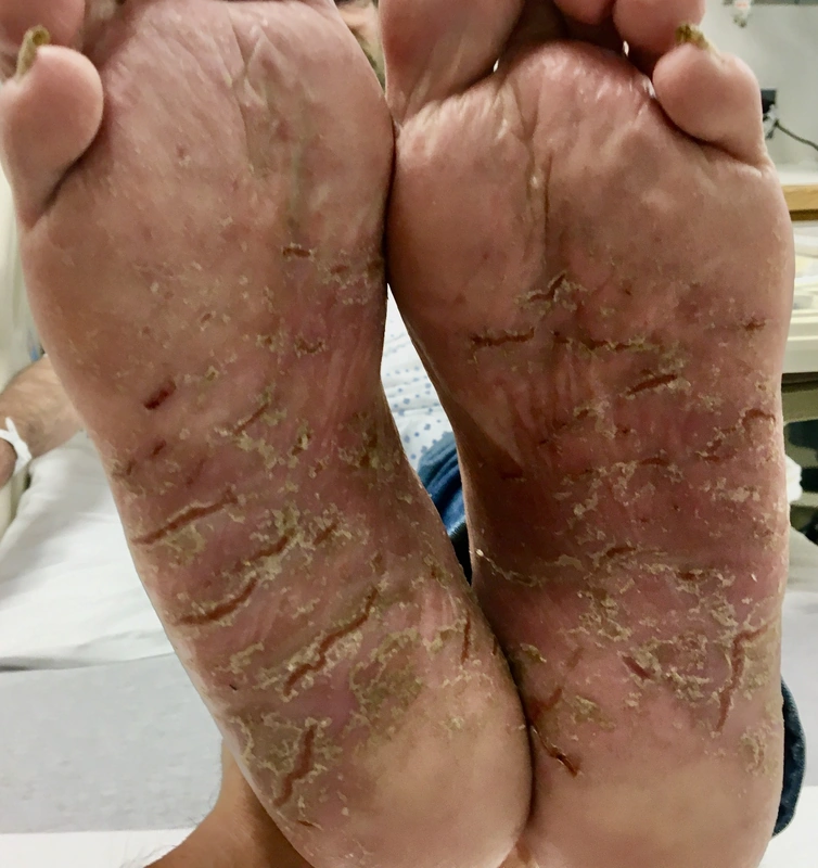 Blickdiagnose-Quiz Fall 42: klinisches Bild – welche Diagnose?