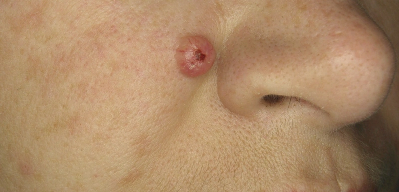 Spot-diagnosis quiz case 18: clinical image – which diagnosis?