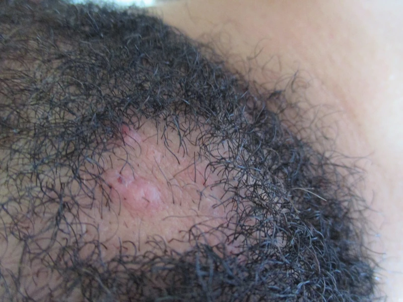 Blickdiagnose-Quiz Fall 14: klinisches Bild – welche Diagnose?