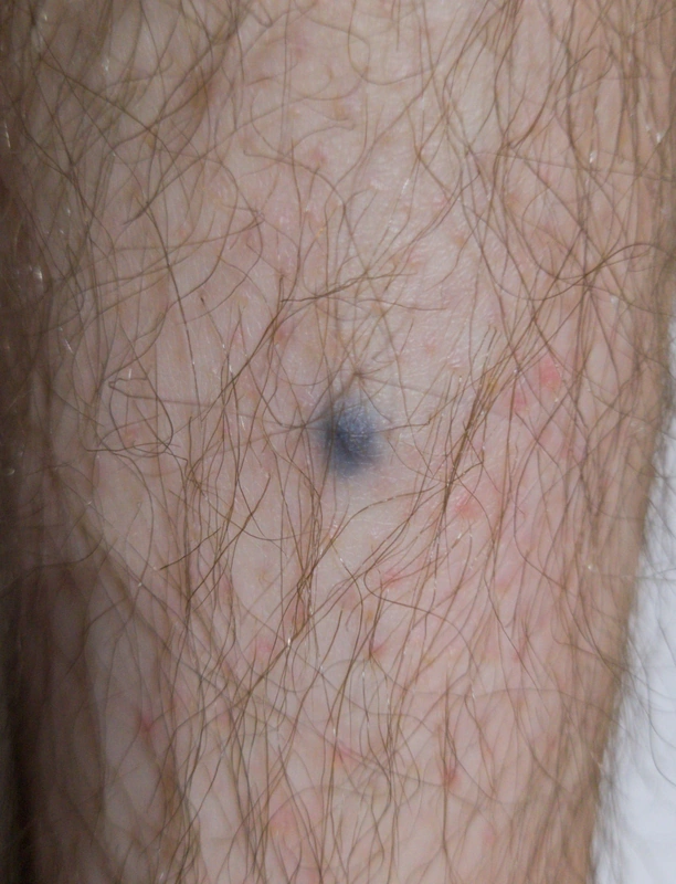 Spot-diagnosis quiz case 35: clinical image – which diagnosis?