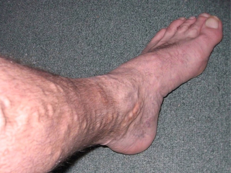 Blickdiagnose-Quiz Fall 18: klinisches Bild – welche Diagnose?