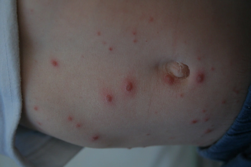 Blickdiagnose-Quiz Fall 12: klinisches Bild – welche Diagnose?