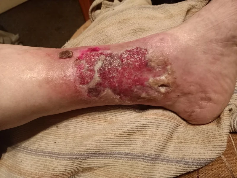Blickdiagnose-Quiz Fall 19: klinisches Bild – welche Diagnose?