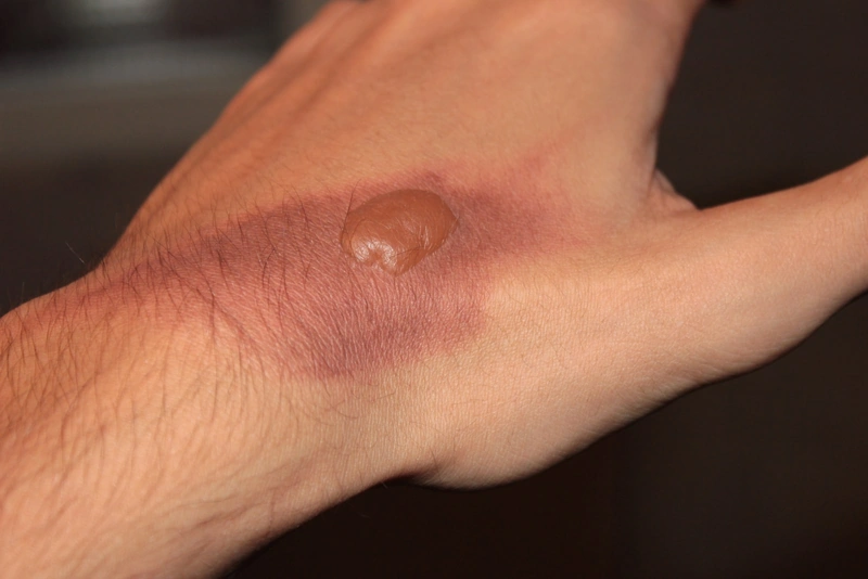 Blickdiagnose-Quiz Fall 20: klinisches Bild – welche Diagnose?
