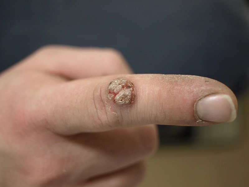 Blickdiagnose-Quiz Fall 43: klinisches Bild – welche Diagnose?