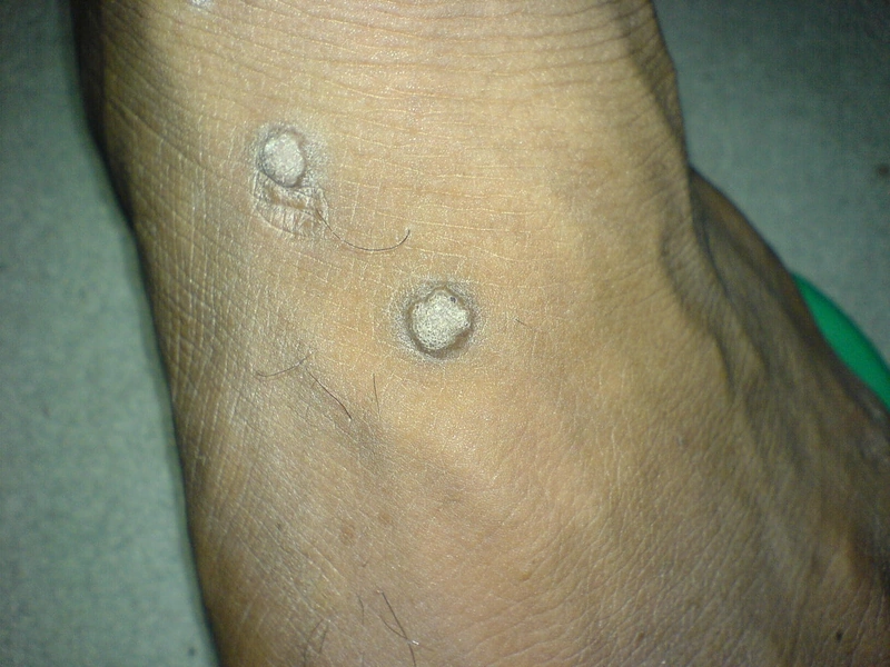 Blickdiagnose-Quiz Fall 13: klinisches Bild – welche Diagnose?