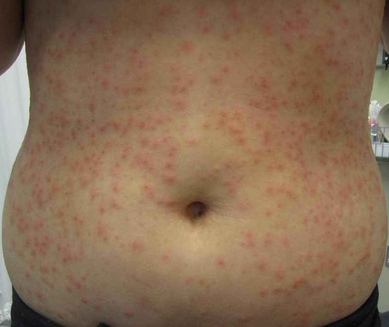 Blickdiagnose-Quiz Fall 45: klinisches Bild – welche Diagnose?