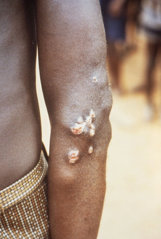 Blickdiagnose-Quiz Fall 47: klinisches Bild – welche Diagnose?