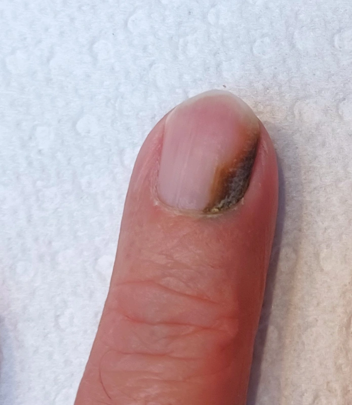 Blickdiagnose-Quiz Fall 15: klinisches Bild – welche Diagnose?