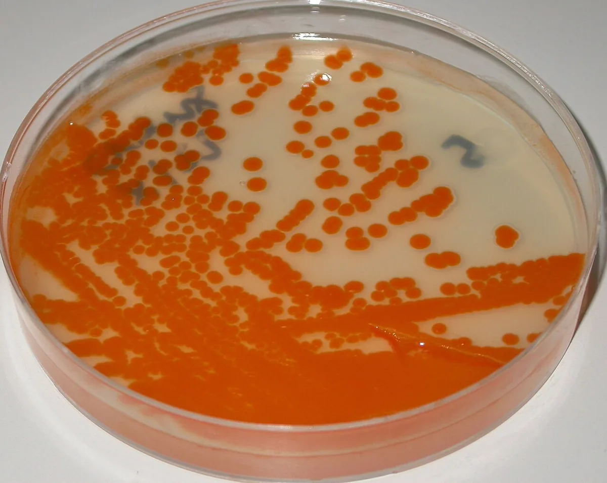 Group B streptococcus in pregnancy – Histology & cytology: Culture: orange-pigmented colonies of Streptococcus agalactiae (group B streptococci) on Granada agar