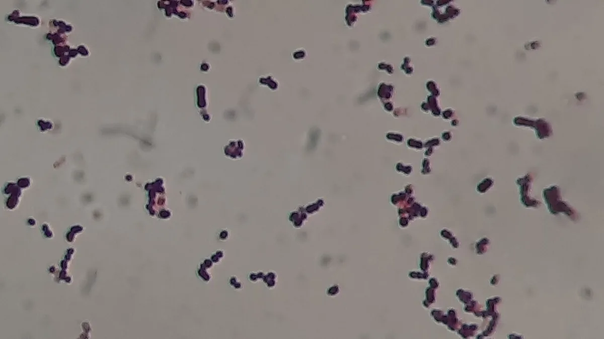 Group B streptococcus in pregnancy – Histology & cytology: Microscopy (Gram stain): Gram-positive cocci in pairs and short chains – Streptococcus agalactiae from culture