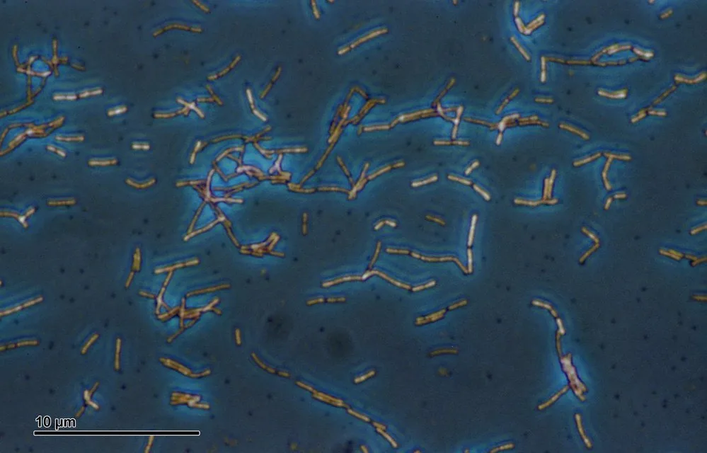 Bacterial vaginosis – Histology & cytology: Lactobacilli (Döderlein's bacilli) in phase contrast — pure culture of Lactobacillus acidophilus with an inserted scale bar