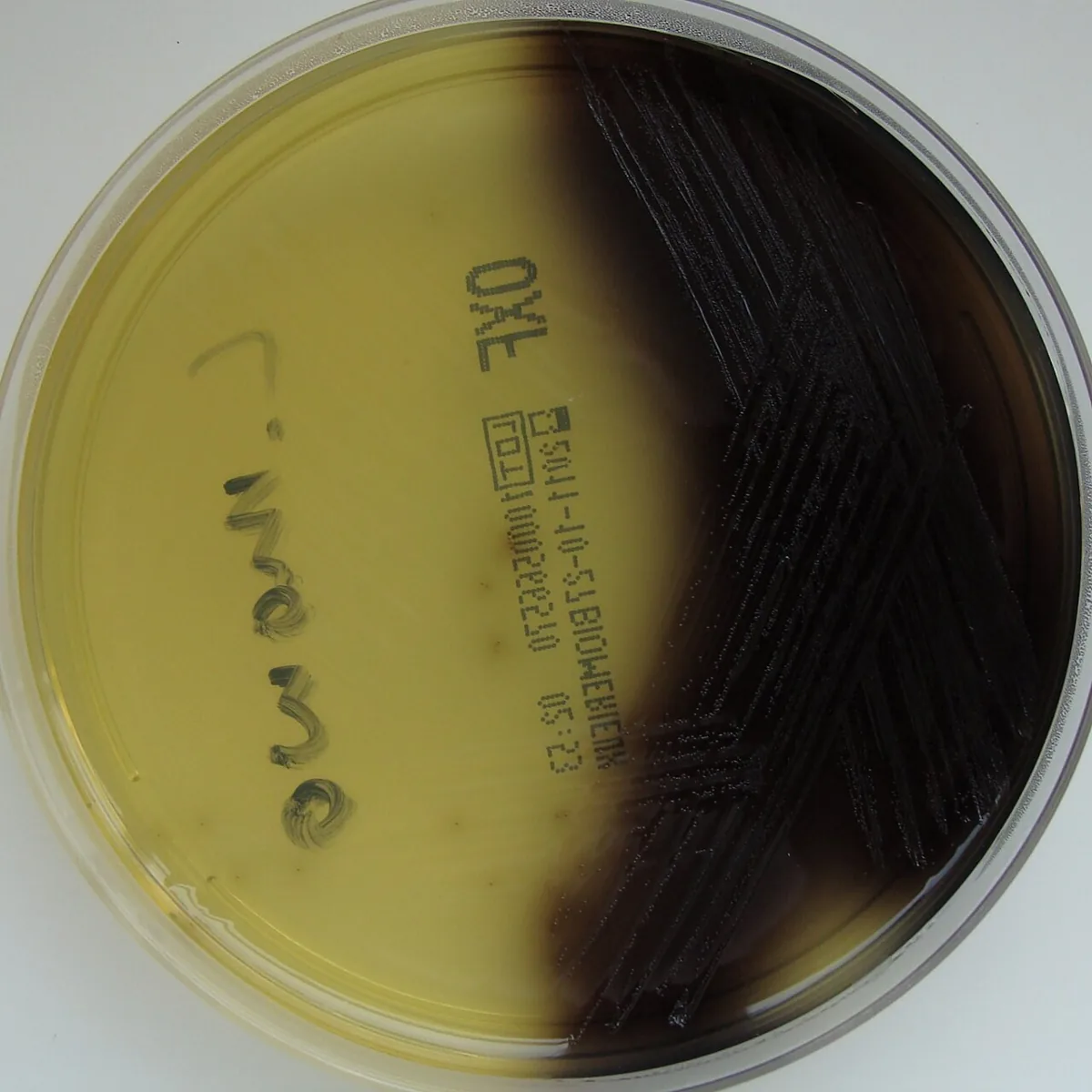 Listeriose in der Schwangerschaft – Histologie & Zytologie: Kultur: Listeria monocytogenes auf Oxford-Listerien-Agar – Schwarzfärbung des Mediums durch Äskulinspaltung