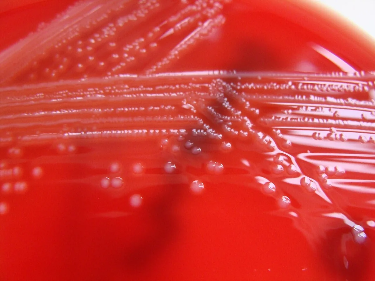 Listeriose in der Schwangerschaft – Histologie & Zytologie: Kultur: kleine, glänzende Kolonien von Listeria monocytogenes mit schmaler Hämolysezone auf Blutagar