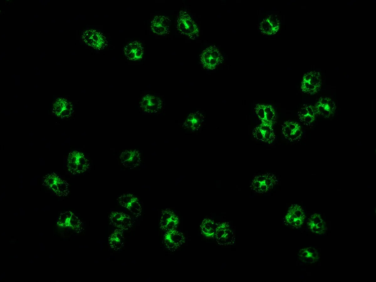 Granulomatosis with polyangiitis (GPA) – Indirect immunofluorescence on neutrophils: granular cytoplasmic pattern (c-ANCA) caused by PR3 antibodies