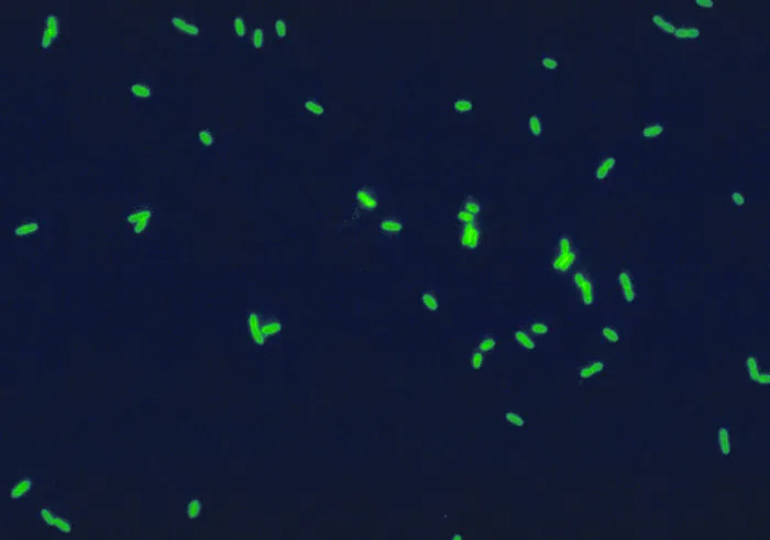 Legionnaires' disease – Direct immunofluorescence: Legionella pneumophila as short, bright green rods