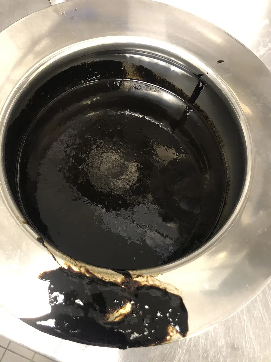 Upper gastrointestinal bleeding – clinical photo: Tarry stool (melaena): black, shiny, sticky stool from duodenal bleeding