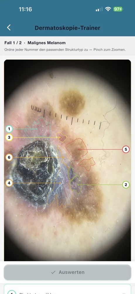 Dermatoskopie-Kurs