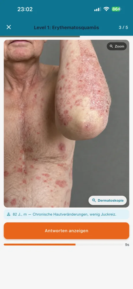 Spot-Diagnose