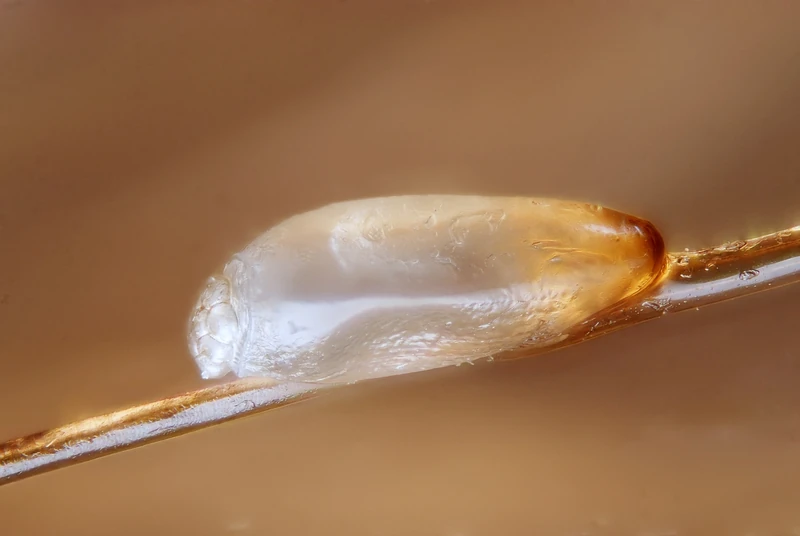 Pediculosis capitis: Nisse: das etwa 0,6 mm große, ovale Ei der Kopflaus ist mit einer bräunlichen Kittsubstanz fest am Haarschaft verklebt und lässt sich – anders als Kopfschuppen – nicht abstreifen (Makroaufnahme, Foto: Gilles San Martin, Wikimedia Commons, CC BY-SA 2.0)