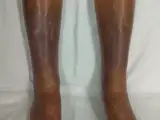 Stasis dermatitis (venous eczema) – clinical photo